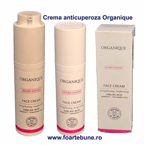 Crema anticuperoza